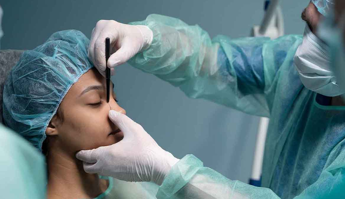 Rhinoplasty-2