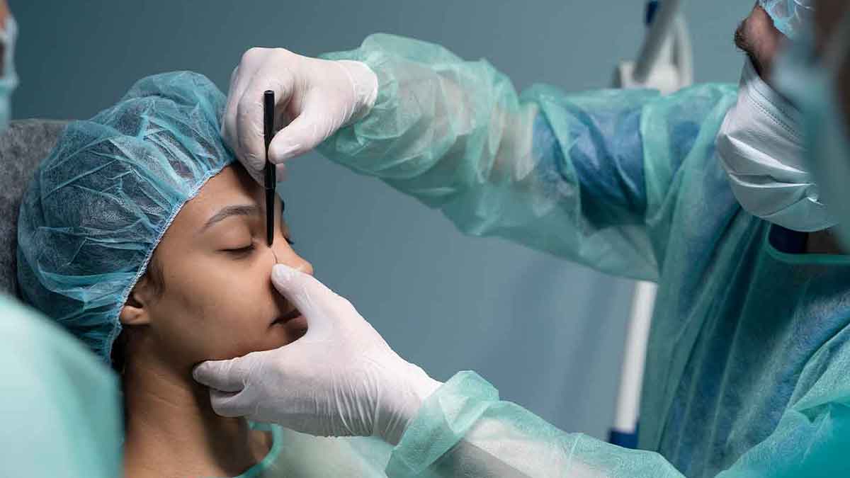 Rhinoplasty-2