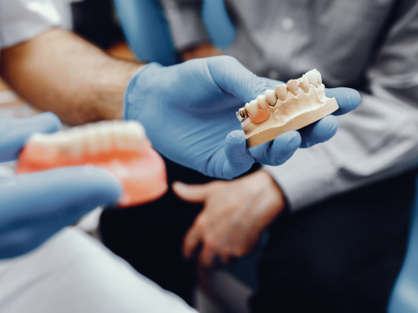 dental implant