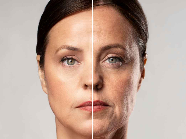 facelift-surgery