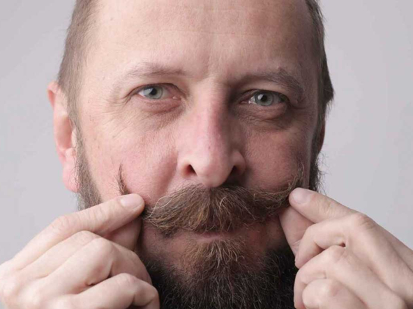 moustache-transplantation